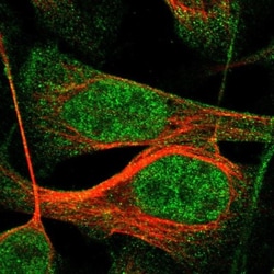IQCE Antibody, Novus Biologicals 25 &mu;L; Unlabeled:Antibodies, Polyclonal